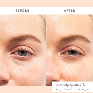 Skin Remedy Soothing Eye Gels - 5 Pack
