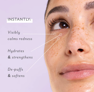 Skin Remedy Soothing Eye Gels - 5 Pack